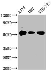 STK3 Antibody (aa323-450)