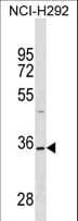 Polyclonal Rabbit anti-Human TSPAN18 / TSPAN Antibody (aa93-120, WB)