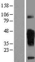 TMIGD2 Protein (Over-Expression Lysate Myc-DDK (Flag))