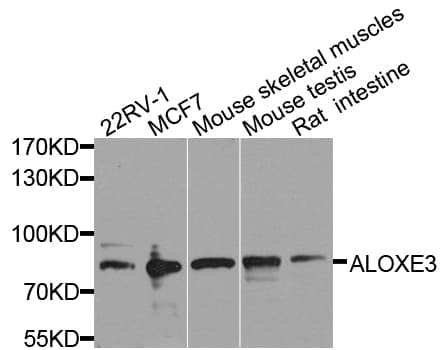 ALOXE3 Antibody