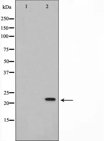 NME2 Antibody