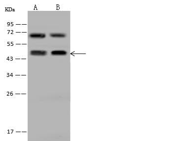 Polyclonal Rabbit anti-Human KRT20 / CK20 / Cytokeratin 20 Antibody (WB)