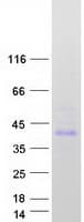 Human EBAG9 / RCAS1 Protein (Recombinant Myc-DDK (Flag))
