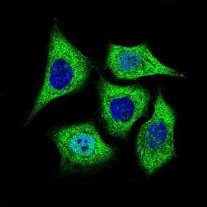 Monoclonal Mouse anti-Human ALDH2 Antibody (clone 4G6A3, Amino Acid: 317-517, IHC, IF, WB)