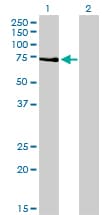 PRKCZ / PKC-Zeta Antibody (clone 2D1)