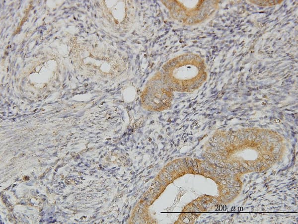 Monoclonal Mouse anti-Human PIH1D1 Antibody (clone 1E8, IHC, WB)