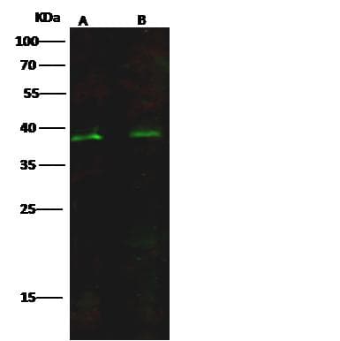 Polyclonal Rabbit anti-Human ISL2 / Islet 2 Antibody (Preservative Free, IF, WB)