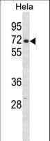 Polyclonal Rabbit anti-Human CPSF6 Antibody (aa23-51, WB)