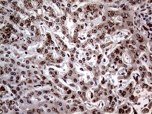 Monoclonal Mouse anti-Human ERBB4 / HER4 Antibody (clone OTI1H6, aa992-1308, IHC, WB)