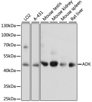 Polyclonal Rabbit anti-Human ADK / Adenosine Kinase Antibody (WB)