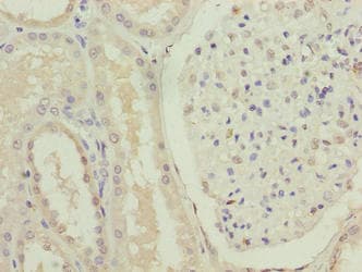 Polyclonal Rabbit anti-Human FOXR2 Antibody (IHC, WB)