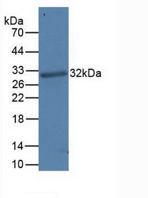 CD274 / B7-H1 / PD-L1 Antibody
