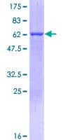 Human PYCR1 Protein (Recombinant GST)