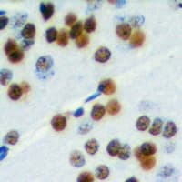 Polyclonal Rabbit anti-Human ELK1 Antibody (C-Terminus, IHC, WB)