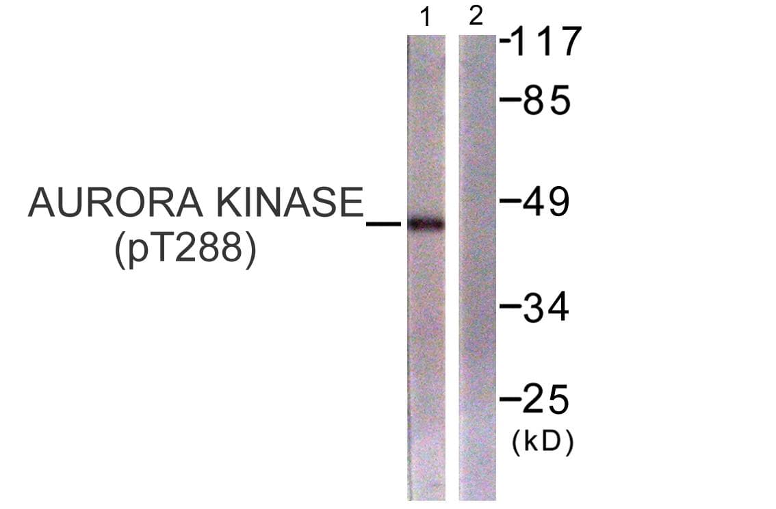 AURKA / Aurora-A Antibody (phospho-Thr288)