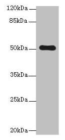 Polyclonal Rabbit anti-Human C4orf37 Antibody (IHC, WB)