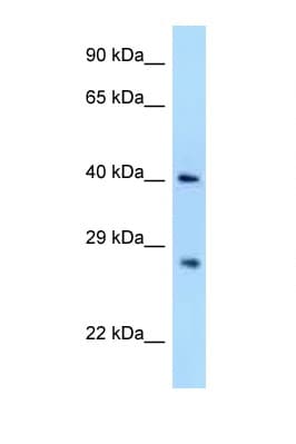 AIDA Antibody (aa48-97)
