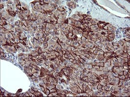 Monoclonal Mouse anti-Human CD44 Antibody (clone OTI1E3, IHC, IF, WB)