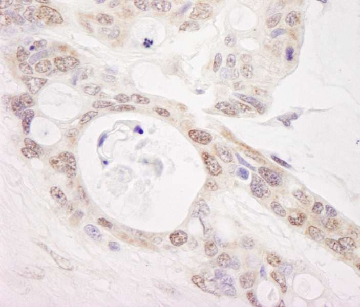 PUS1 Antibody (aa377-427)