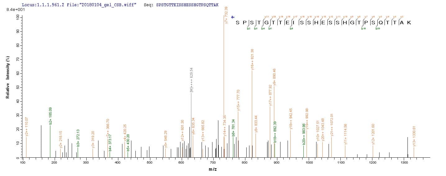 Human IL15RA Protein (Recombinant 10His, N-terminus + Myc, C-terminus)