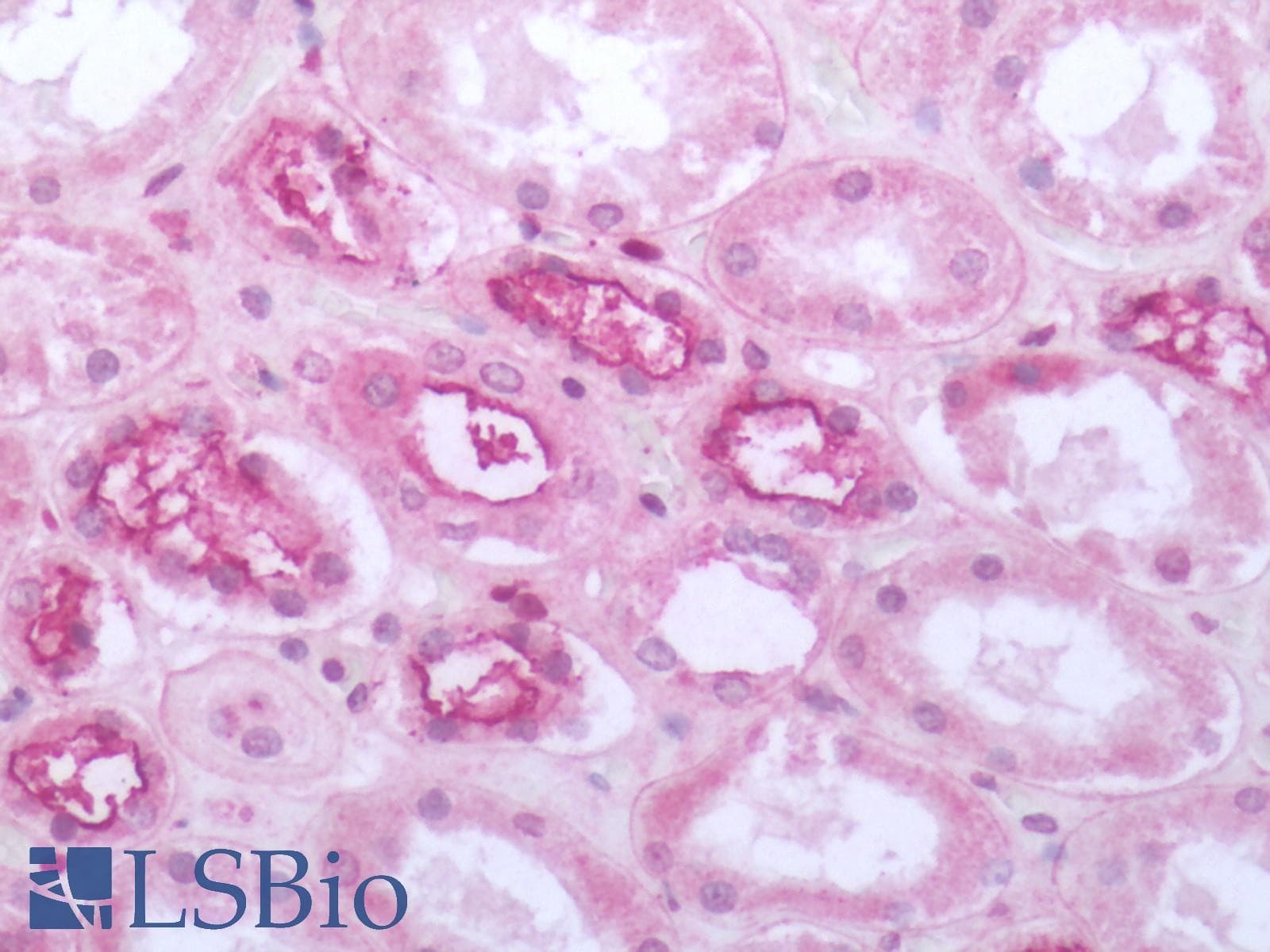 IHC-plus™ Polyclonal Rabbit anti-Human MRGPRF Antibody (C-Terminus, IHC)