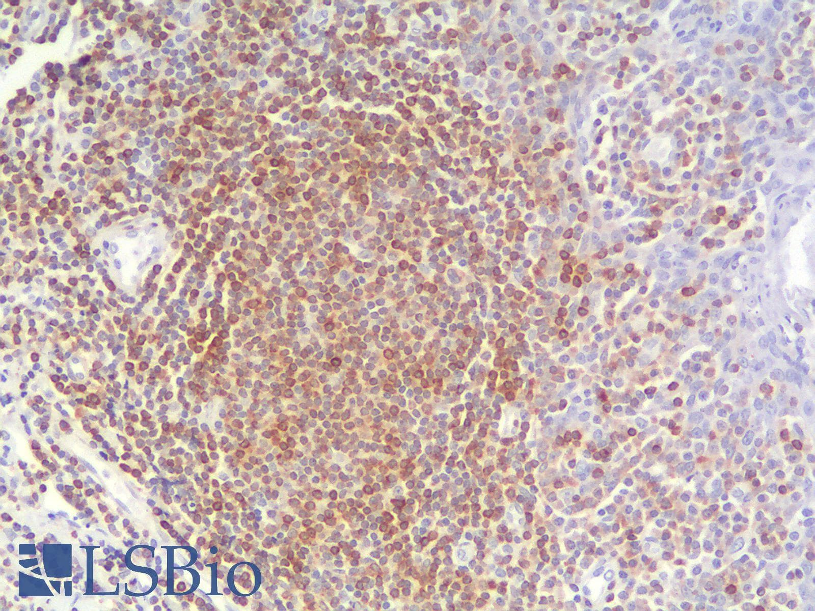 PathPlus™ BCL2 / Bcl-2 Antibody (clone BCL2/2210R)