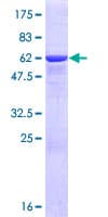 Human GMPR1 / GMPR Protein (Recombinant GST)
