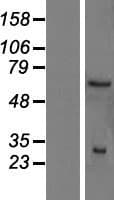 SMN2 Protein (Over-Expression Lysate Myc-DDK (Flag))