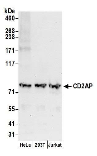 CD2AP Antibody (aa689-639)