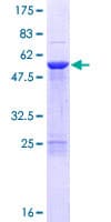 Human COPS7B / CSN7B Protein (Recombinant GST)