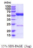 Human ALDH6A1 Protein (Recombinant His)