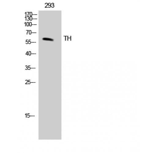 TH / Tyrosine Hydroxylase Antibody (10-90 aa)