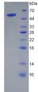 Human CORIN Protein (Recombinant His, N-Terminal)