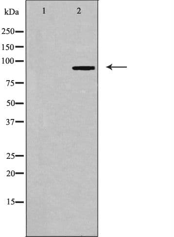 Polyclonal Rabbit anti-Human LTK Antibody (IF, WB)