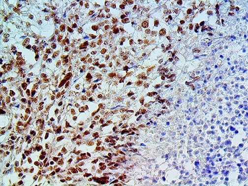 BAP1 Antibody