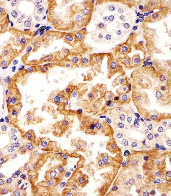 SLC22A2 Antibody (aa57-89)