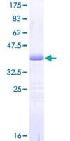 Human PDE3A Protein (Recombinant GST, N-terminus)