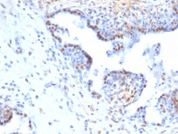RAD51 / RECA Antibody (clone RAD51/2765)