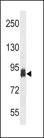 IHC-plus™ PFKP Antibody (aa754-784)