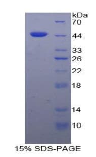 Mouse FGF7 / KGF Protein (Recombinant His-GST)