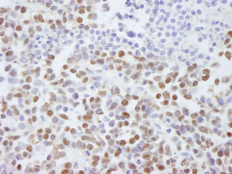 SAFB2 Antibody (aa175-225)