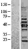 KRT19 / CK19 / Cytokeratin 19 Protein (Over-Expression Lysate Myc-DDK (Flag))