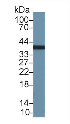 FKSG40 / KAZALD1 Antibody (aa31-304)