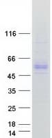 Human AADAC Protein (Recombinant Myc-DDK (Flag))