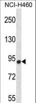 CHSY1 Antibody (aa504-533)