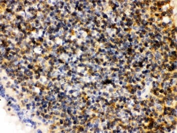 PLK1 / PLK-1 Antibody