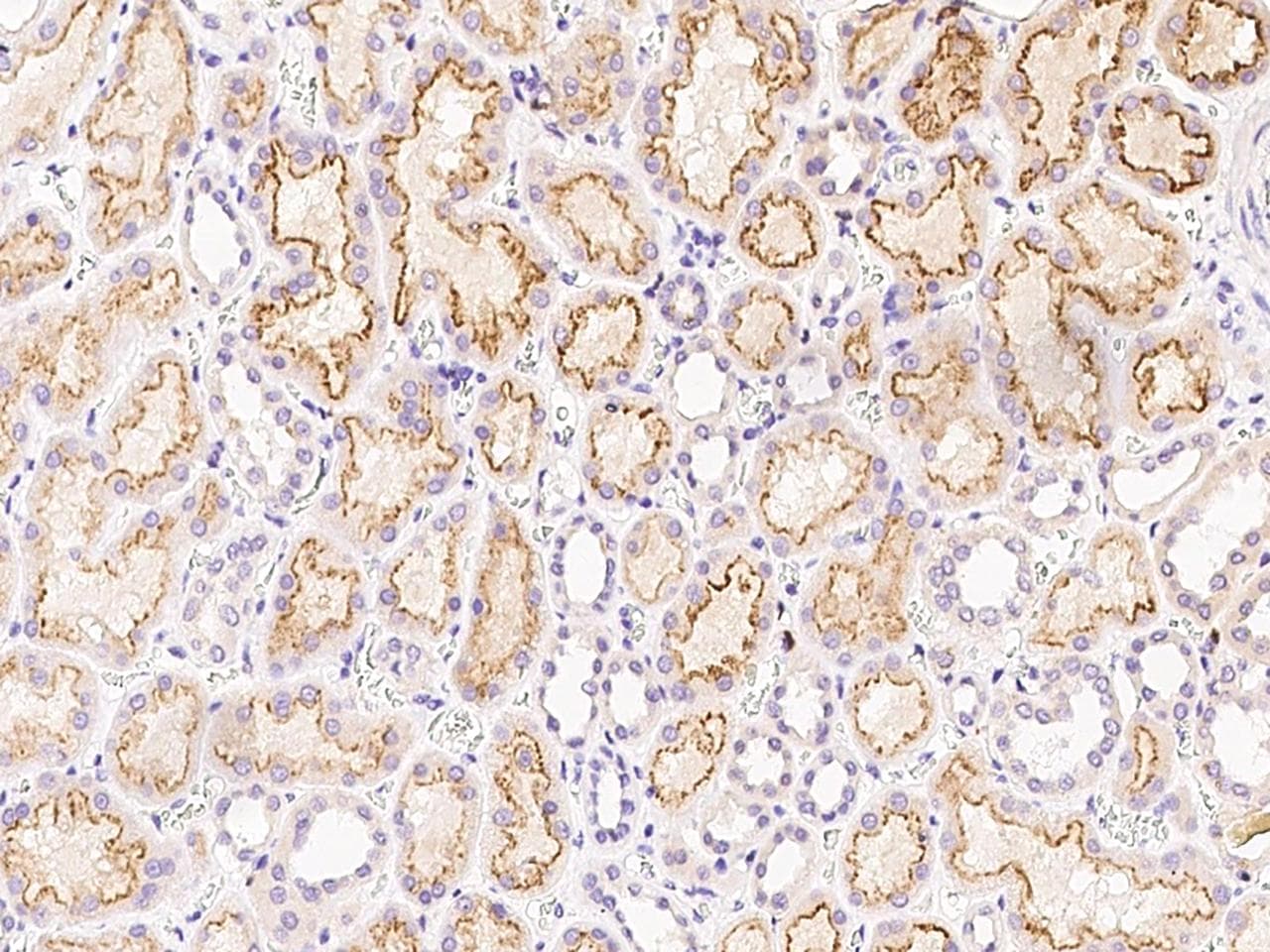 Polyclonal Rabbit anti-Mouse FNDC5 / Irisin Antibody (Preservative Free, IHC)