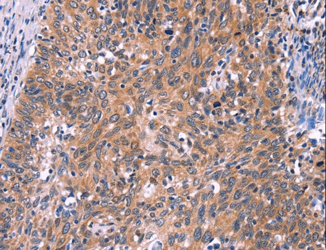 EDN1 / Endothelin 1 Antibody