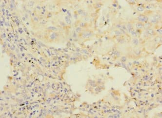 Polyclonal Rabbit anti-Human HAND1 Antibody (IHC)