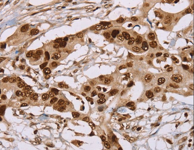 NUP50 Antibody